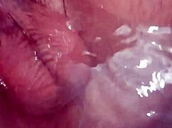 i masturbate my prolapse and get anal pleasure from fucking my hole