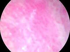 Camera Deep Inside Of The Wet Pussy And Captured The Intense Female Orgasm