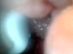 Endoscope Camera Shows Sensitive Penis Parts in Educational Video