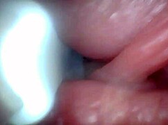 Endoscope Camera Shows Sensitive Penis Parts in Educational Video