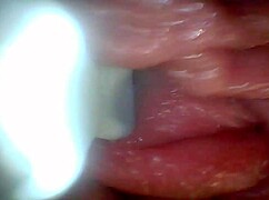 Endoscope Camera Shows Sensitive Penis Parts in Educational Video