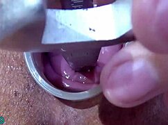 Japanese milf stretches cervix with extreme gyno fucking insertion uncensored